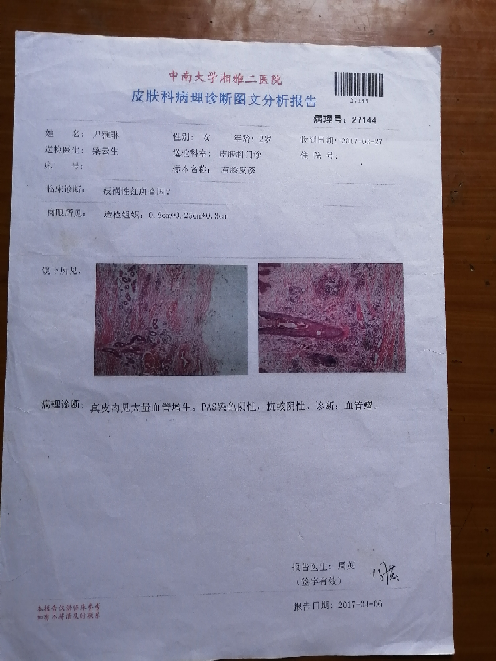 举报邵东市流光岭镇石扬村,村支部书记不作为