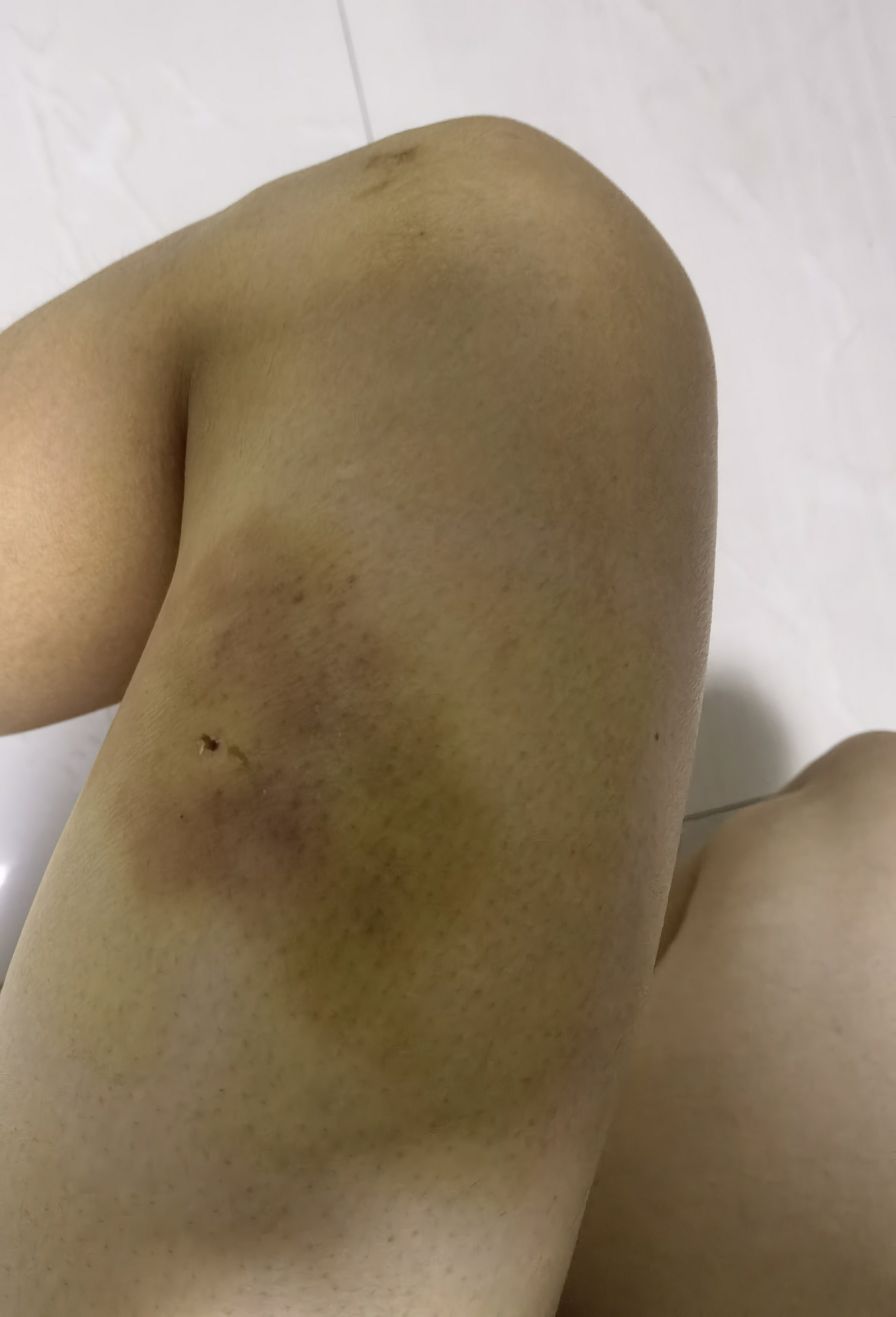 我在路上被人打伤,永州菱角山派出所不处理